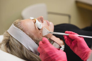 A female BeachGlo Aesthetic client lies on a treatment bed wearing protective eyewear as her provider applies a VI chemical peel. While a peel might not be the first non-surgical face lift in Nags Head clients think of, this treatment can improve skin laxity.