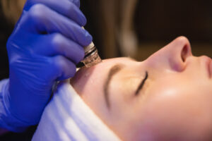 A member of the BeachGlo Aesthetics team performs a Hydrafacial treatment on a female patients. While not as strong as our other sun damage treatments in Nags Head, the Hydrafacial is optimal for monthly maintenance.
