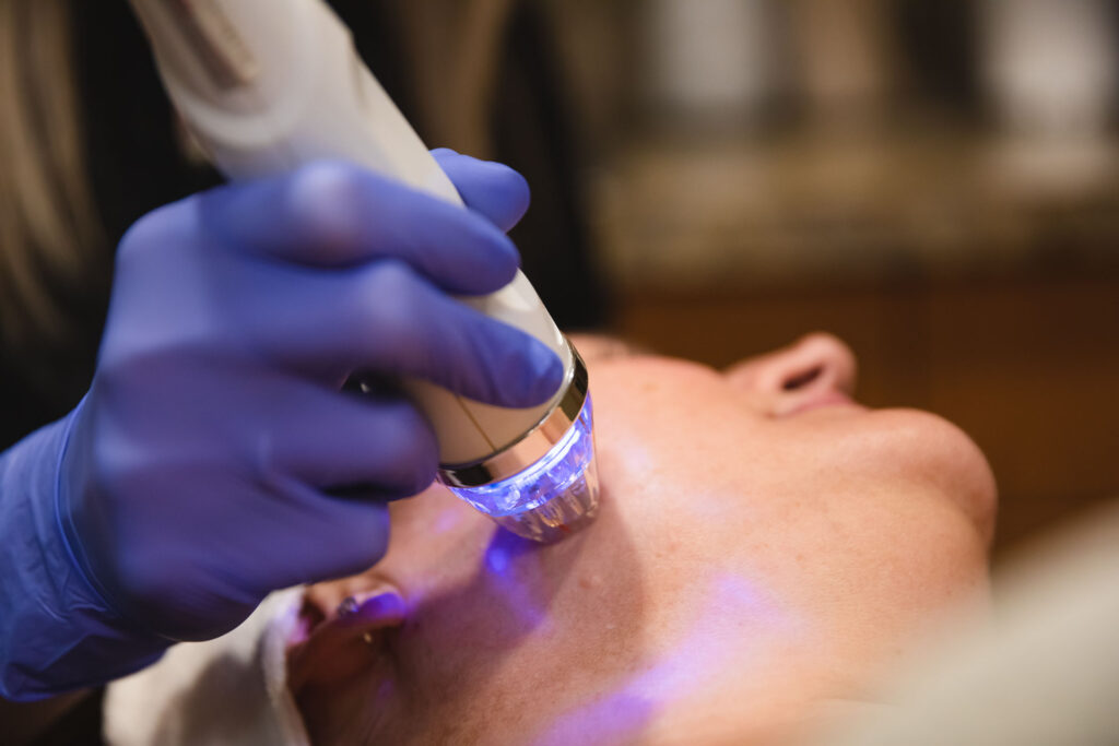 A provider in surgical gloves applies a treatment with radiofrequency for skin near Kill Devil Hills.