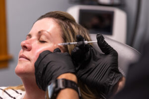 A close up of a female BeachGlo patient receiving Botox near Kitty Hawk. Injecting this neuromodulator near her brows can yield aesthetic benefits like less visible crow's feet or glabellar lines.